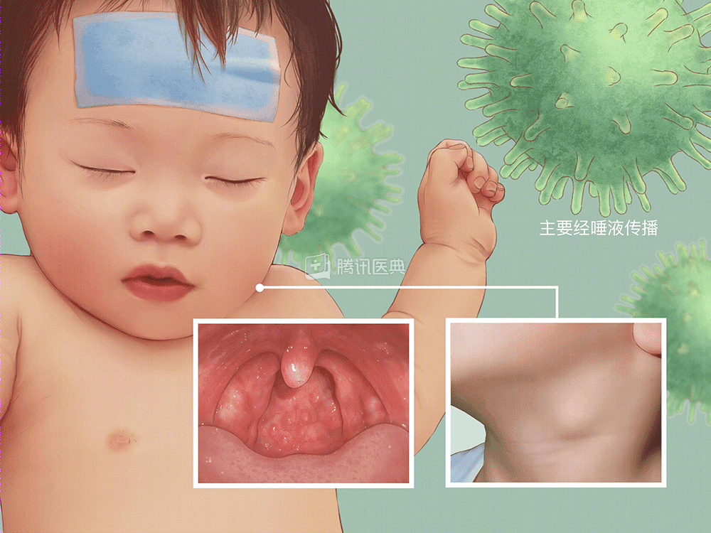 這種病毒 →超90%幼兒感染過，90%以上(shàng)成人(rén)血清抗體陽性？